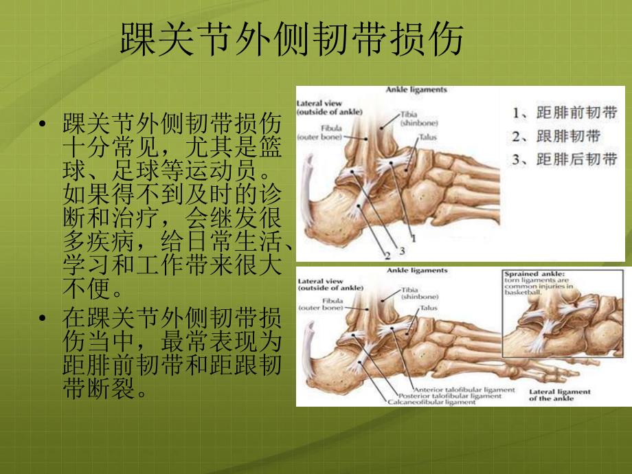 足痛的针灸治疗.ppt_第3页