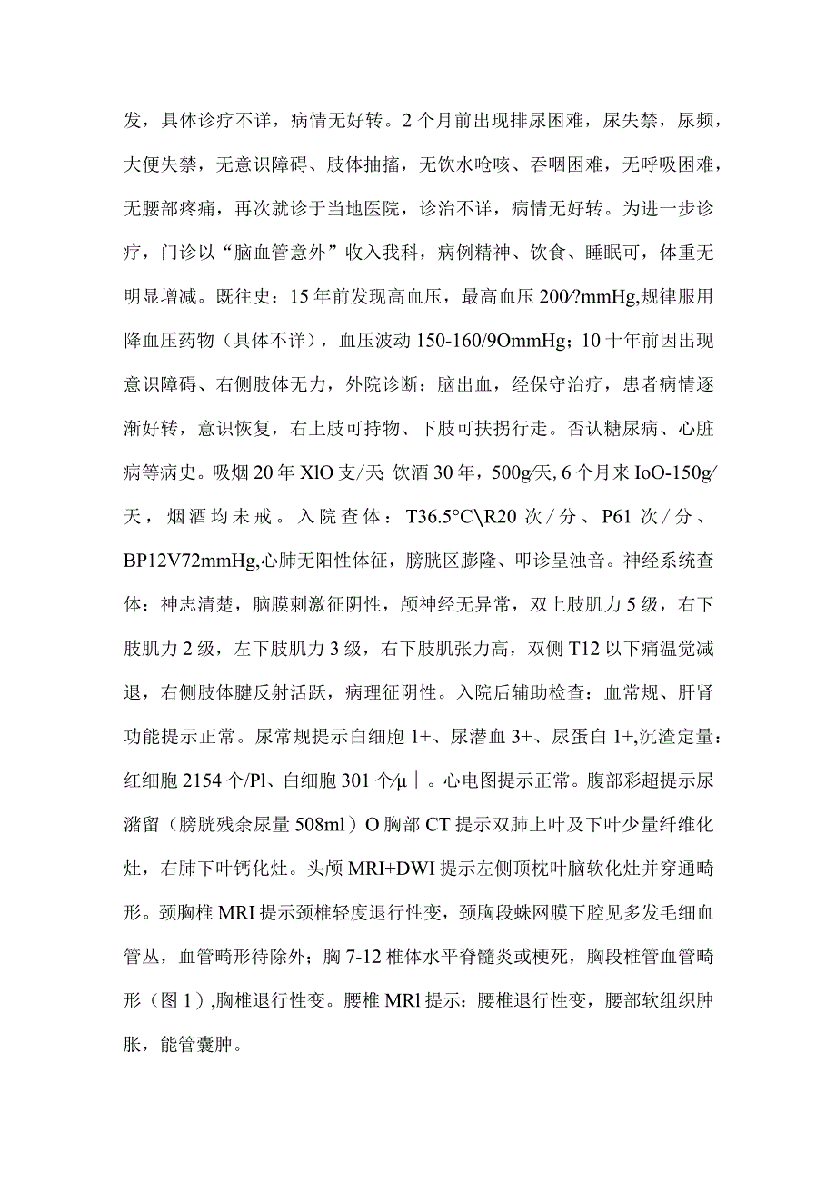 脊髓硬脊膜动静脉瘘1例报道并文献复习.docx_第2页