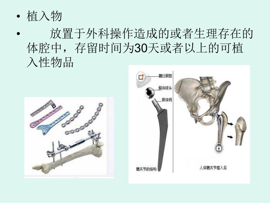 外来器械及植入物.ppt_第3页