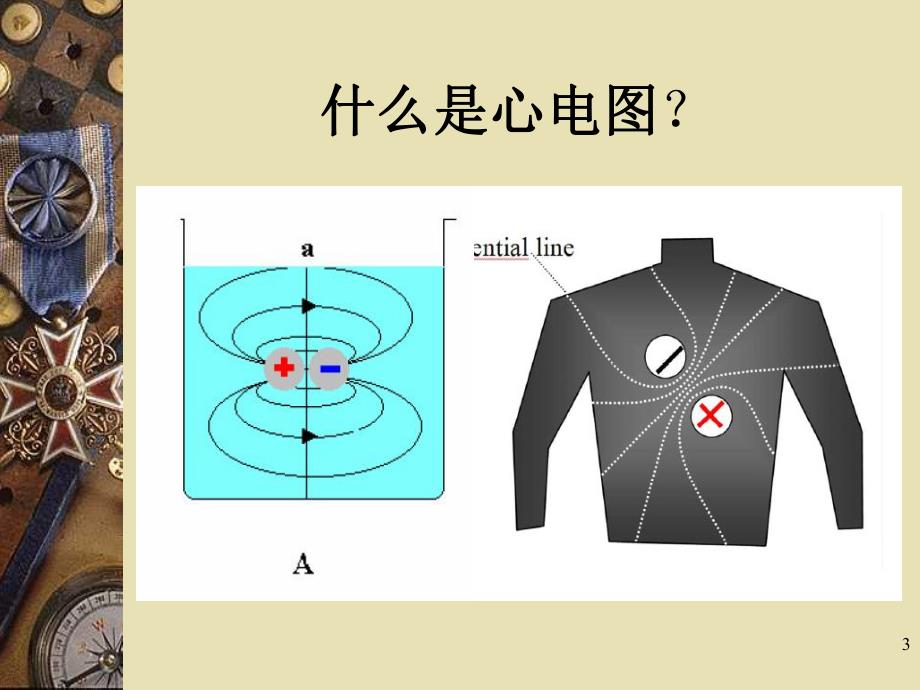 基础心电图.ppt_第3页