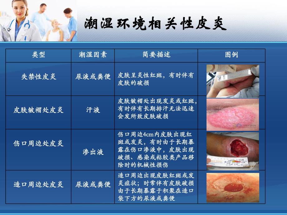 失禁性皮炎.ppt_第3页