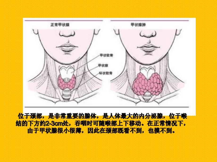 妊娠合并甲状腺疾病讲义.ppt_第3页