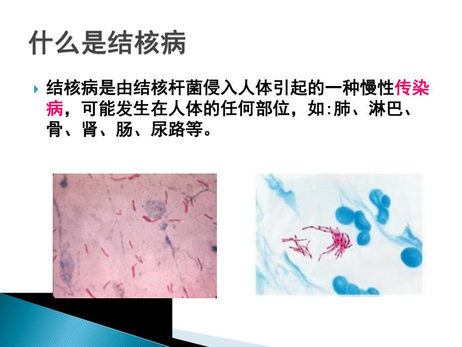 学校结核病防控知识.ppt_第3页