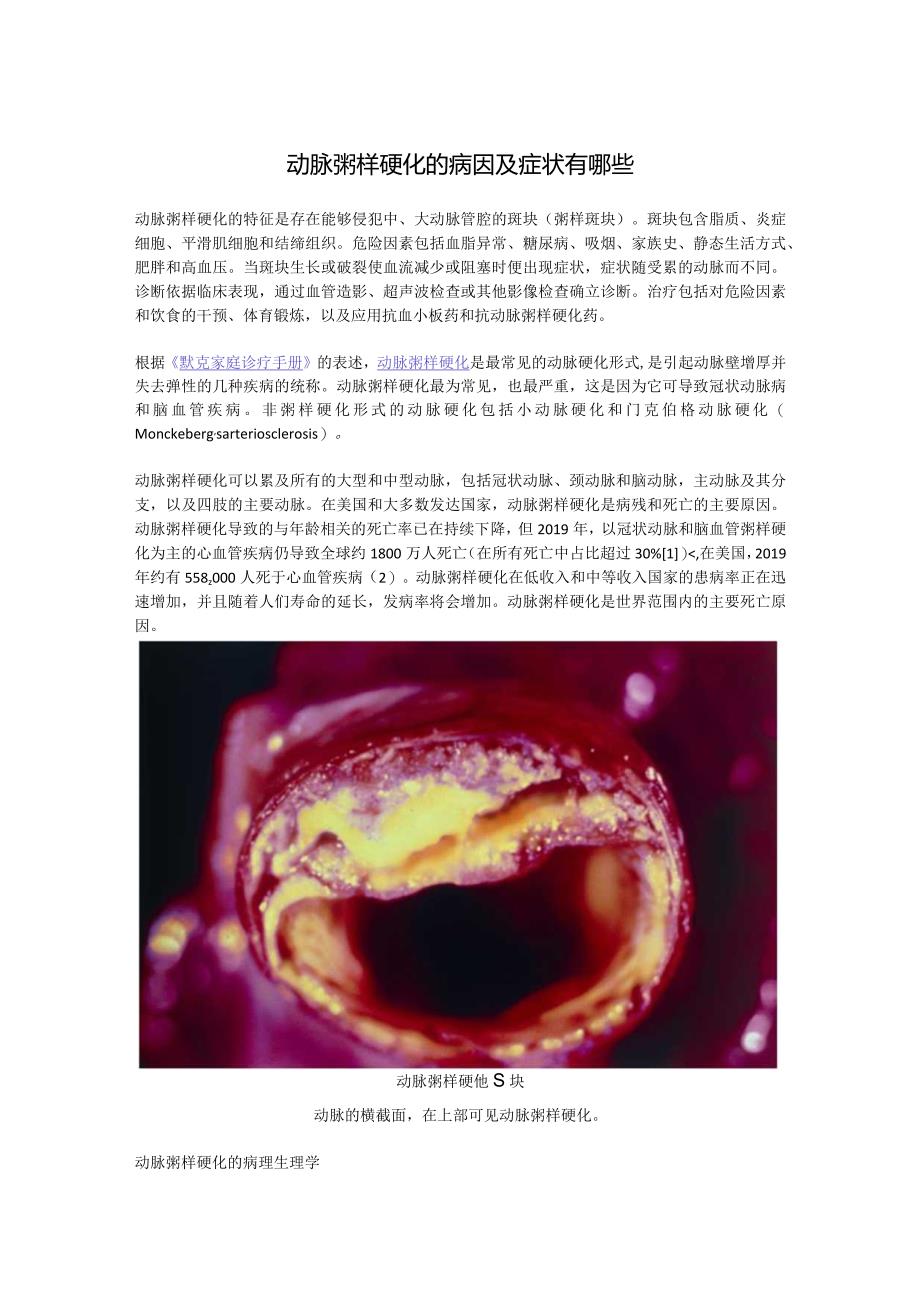 动脉粥样硬化的病因及症状有哪些.docx_第1页