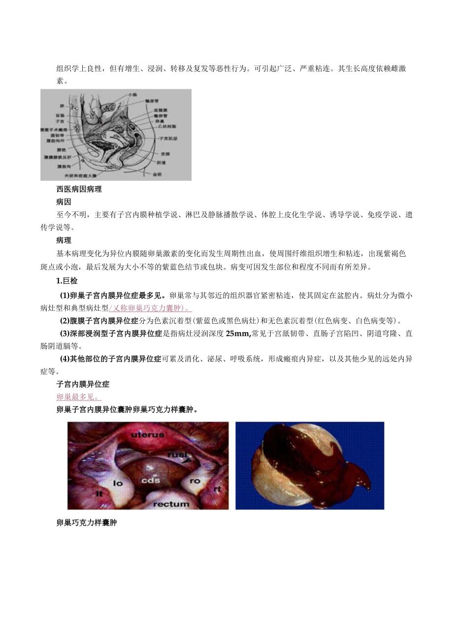 中西医结合妇科学-子宫内膜异位症及子宫腺肌病讲义及练习.docx_第2页