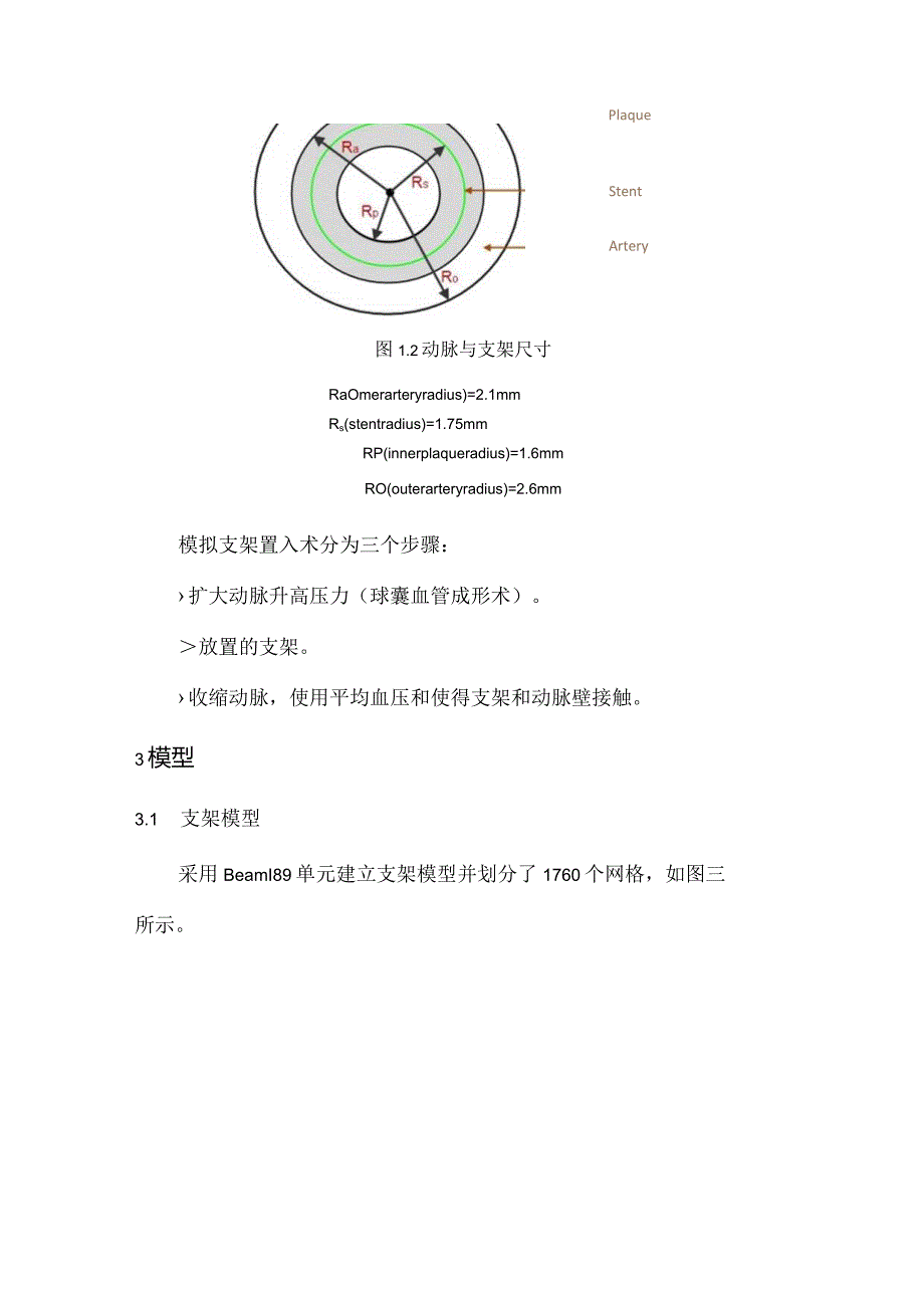 CAE-心血管支架模拟.docx_第2页