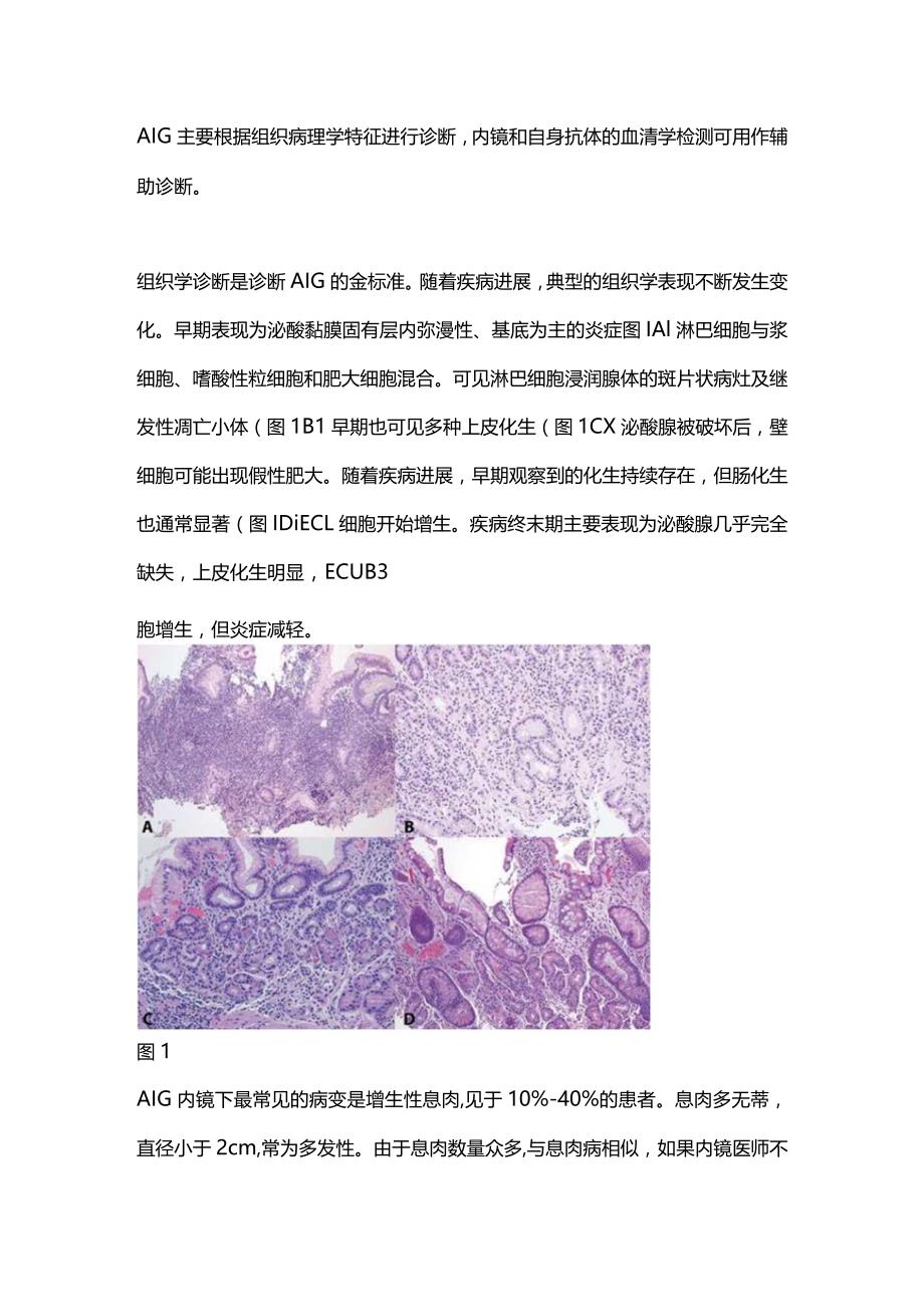 2024自身免疫性胃炎的诊断与治疗要点.docx_第2页