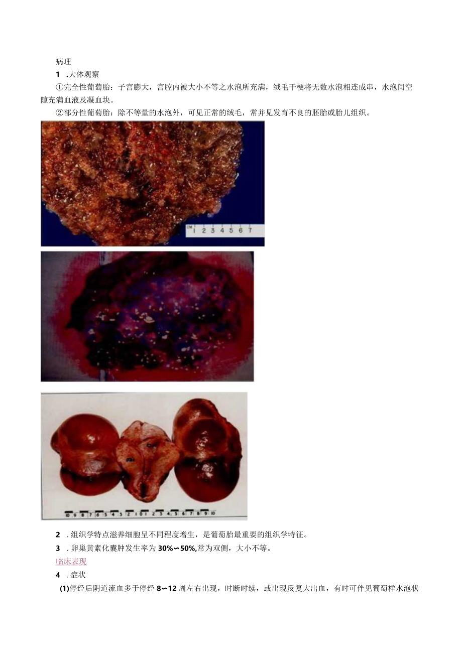 中西医结合妇科学-妊娠滋养细胞疾病课程讲义及练习.docx_第2页