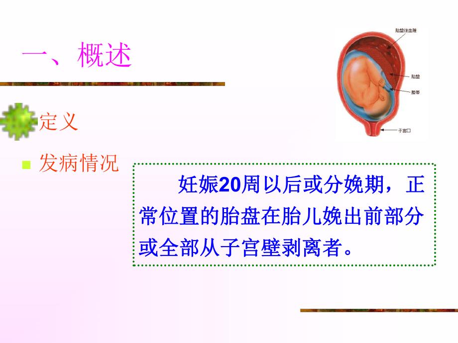 胎盘早剥的护理.ppt_第3页