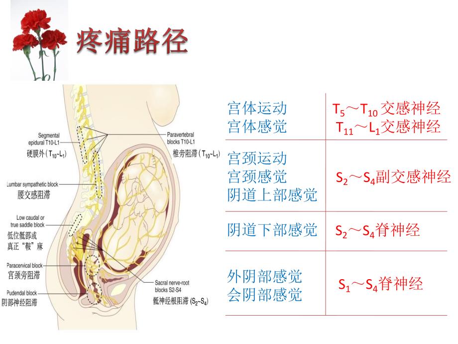 无痛分娩.ppt_第3页