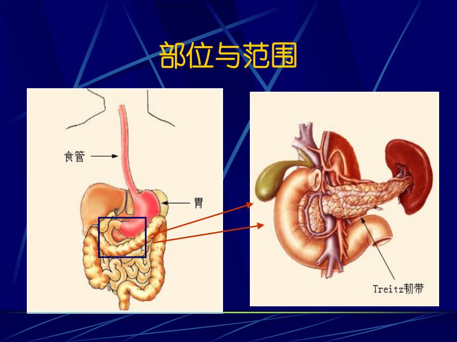 消化道出血急诊学.ppt_第3页