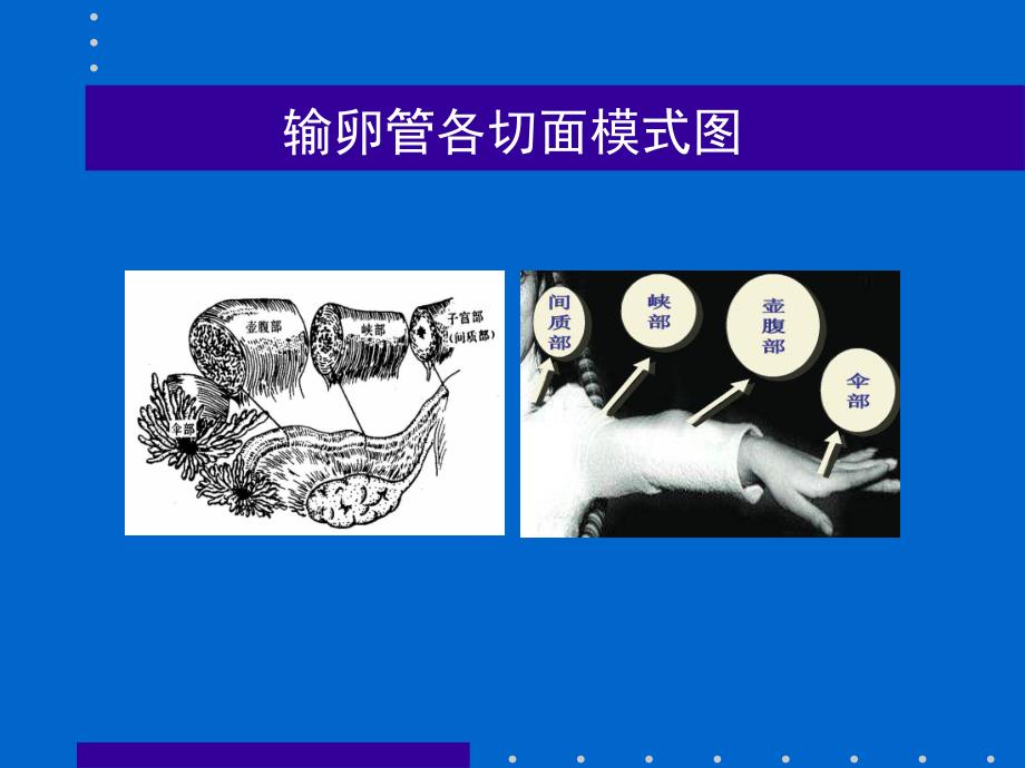 异位妊娠的超声诊断.ppt.ppt_第3页