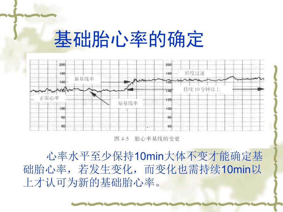 胎儿监护图像.ppt_第2页