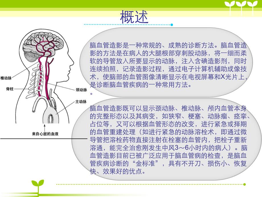 19区：脑血管造影的护理.ppt_第3页