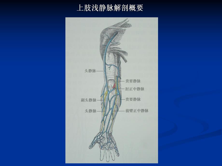 【精品】彩色多普勒超声在上肢浅静脉置管术中的应用.ppt_第2页