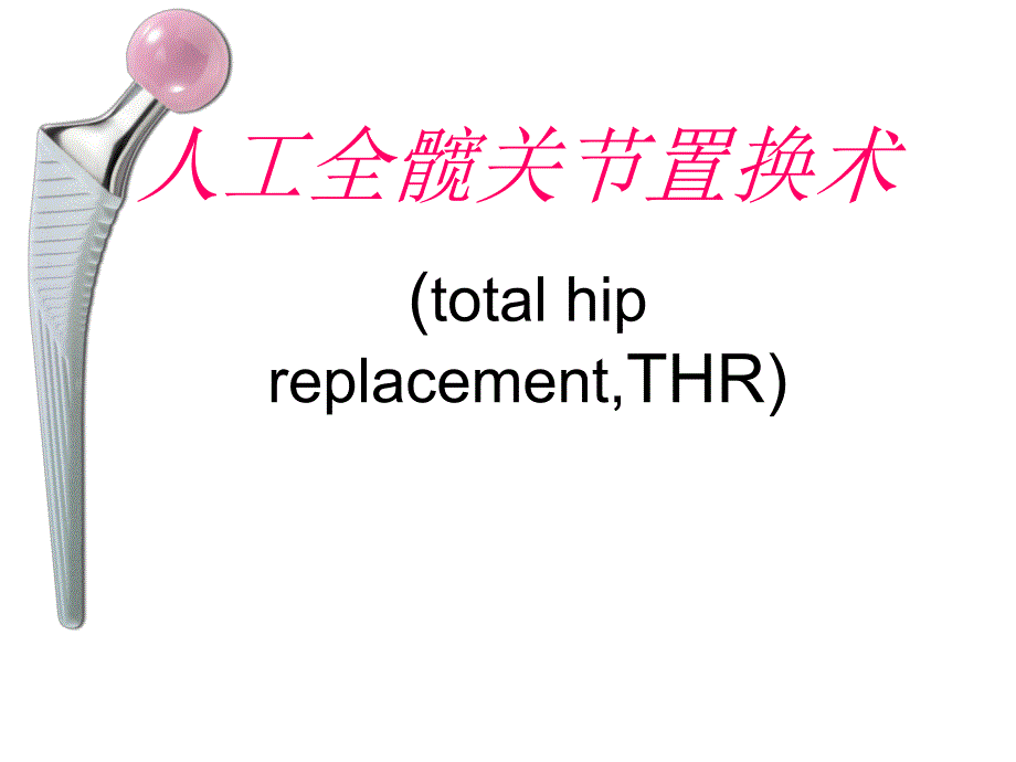 人工全髋关节置换.ppt_第1页