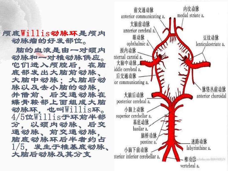 动脉瘤病人护理查房.ppt_第3页