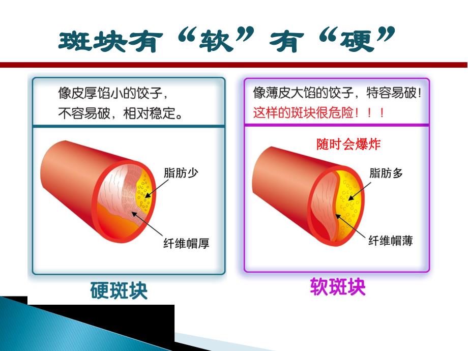 冠心病合并高血压的治疗与护理.ppt_第2页