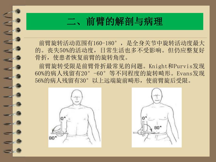 儿童前臂双骨折单骨固定.ppt_第3页