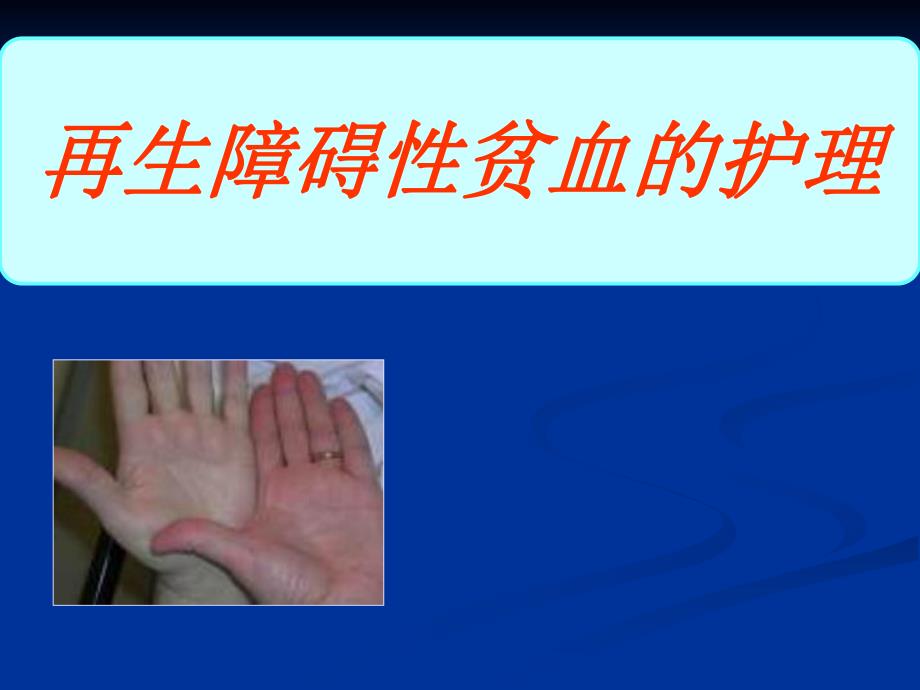 再生障碍性贫血的护理.ppt_第1页