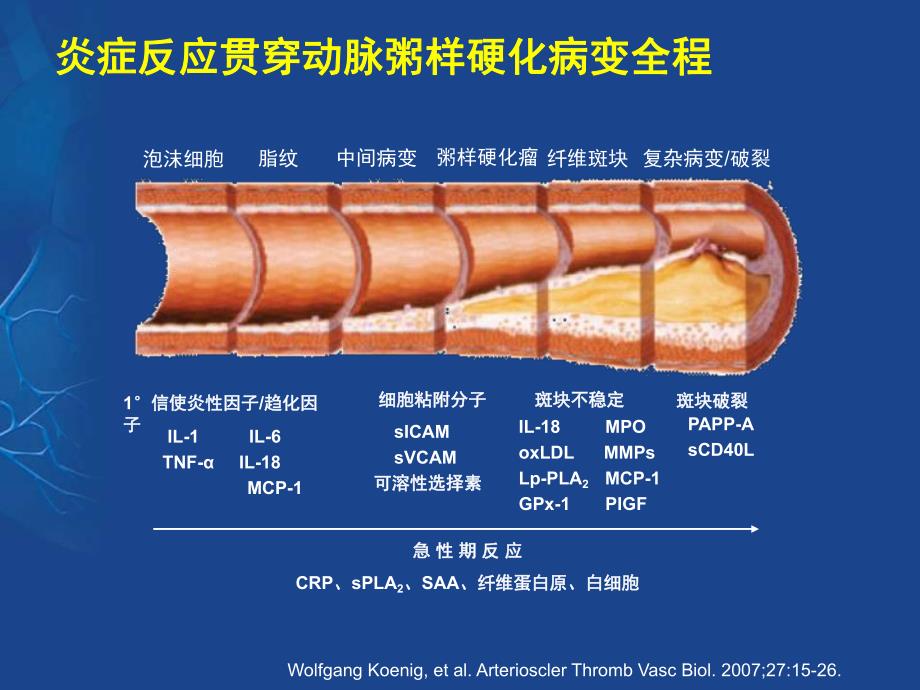 冠心病抗血小板治疗与出血对策.ppt_第2页