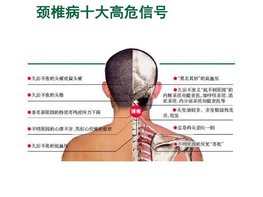 办公室颈椎病、腰痛.ppt_第3页