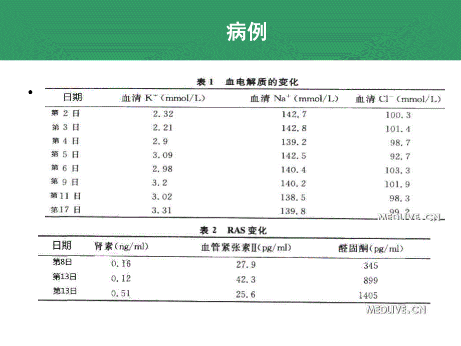 原发性醛固酮增多症.ppt_第3页