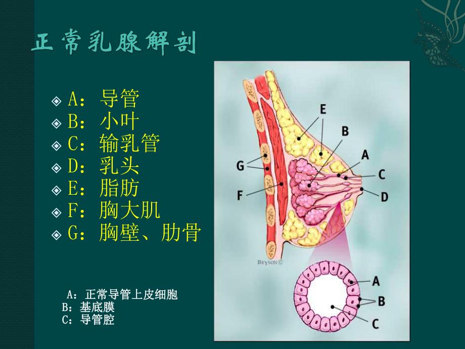 乳腺的超声诊断.ppt_第3页