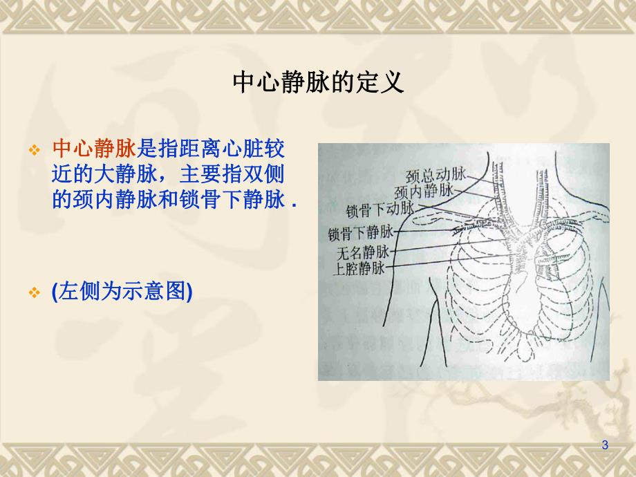 中心静脉置管的护理.ppt_第3页