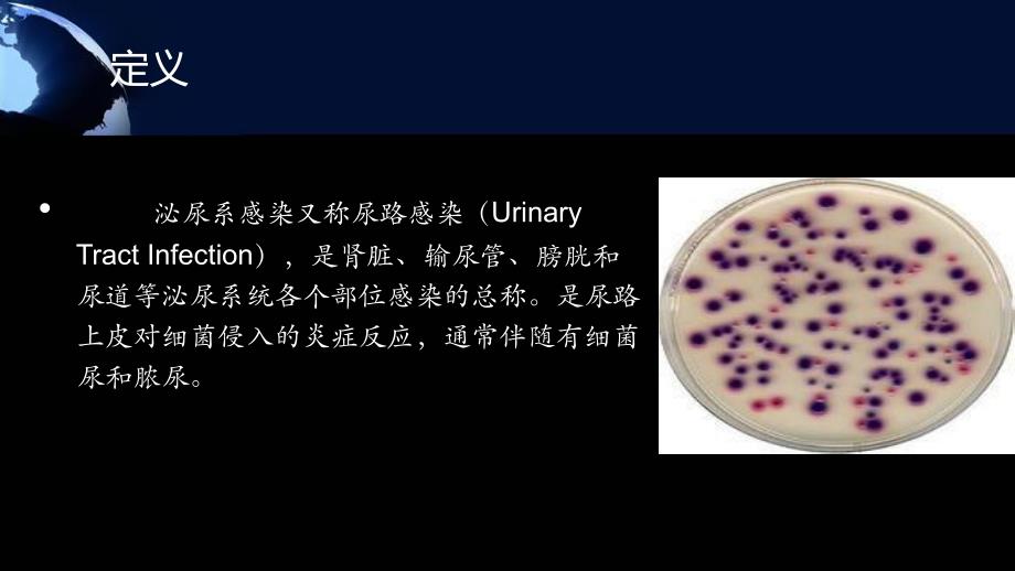 单纯性尿路感染.ppt_第3页