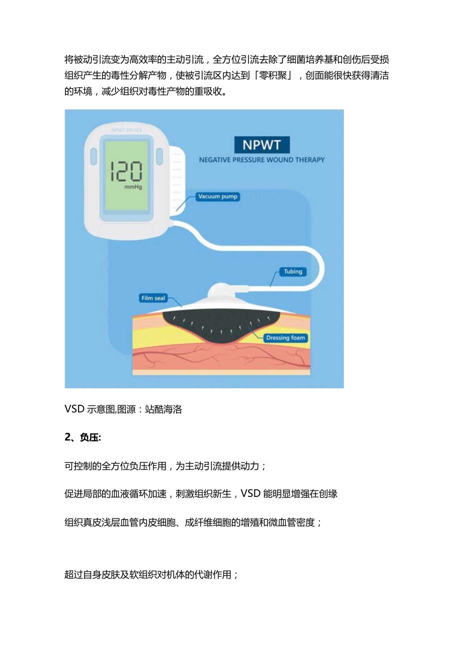 负压封闭引流技术VSD操作流程、并发症处理及注意事项2024.docx_第2页