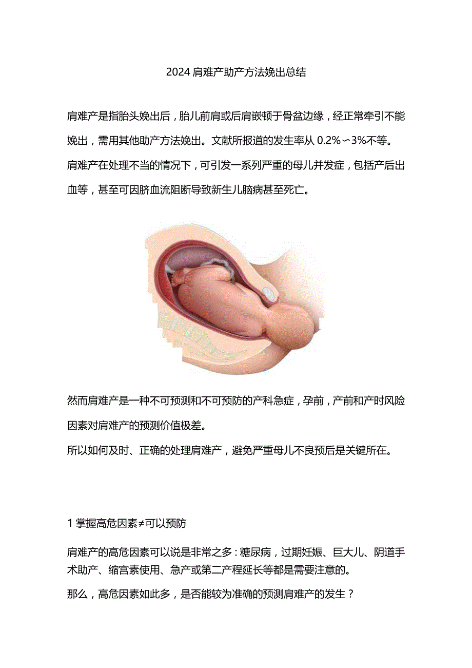 2024肩难产助产方法娩出总结.docx_第1页