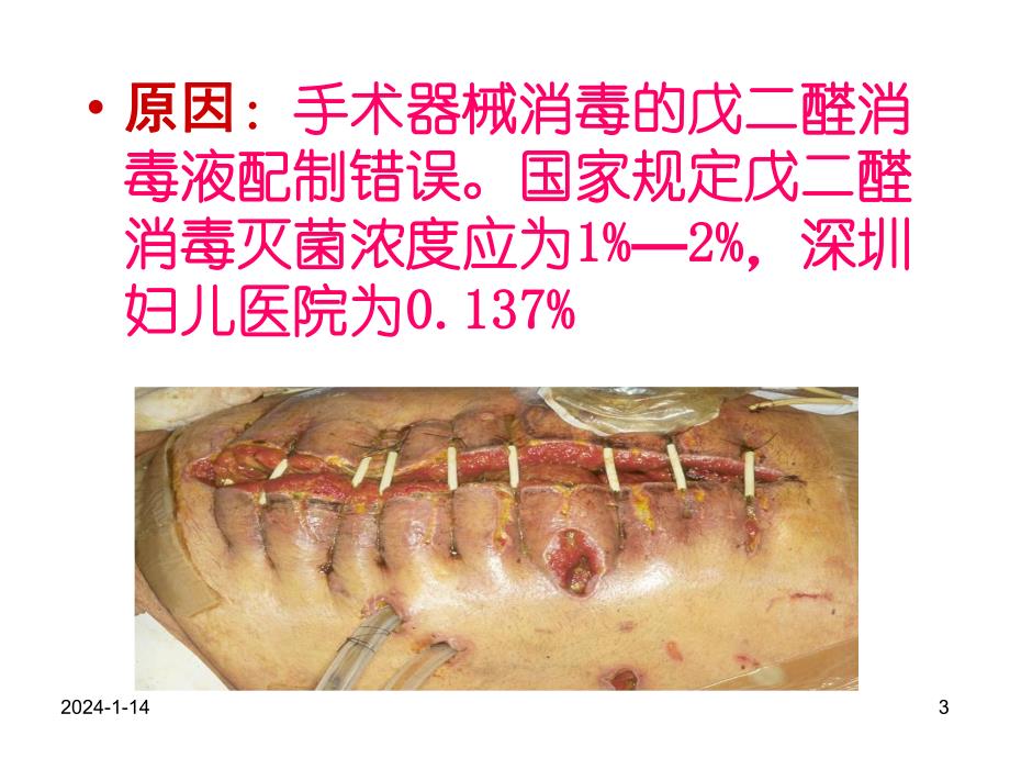 历次重大医院感染事件回顾　.ppt_第3页