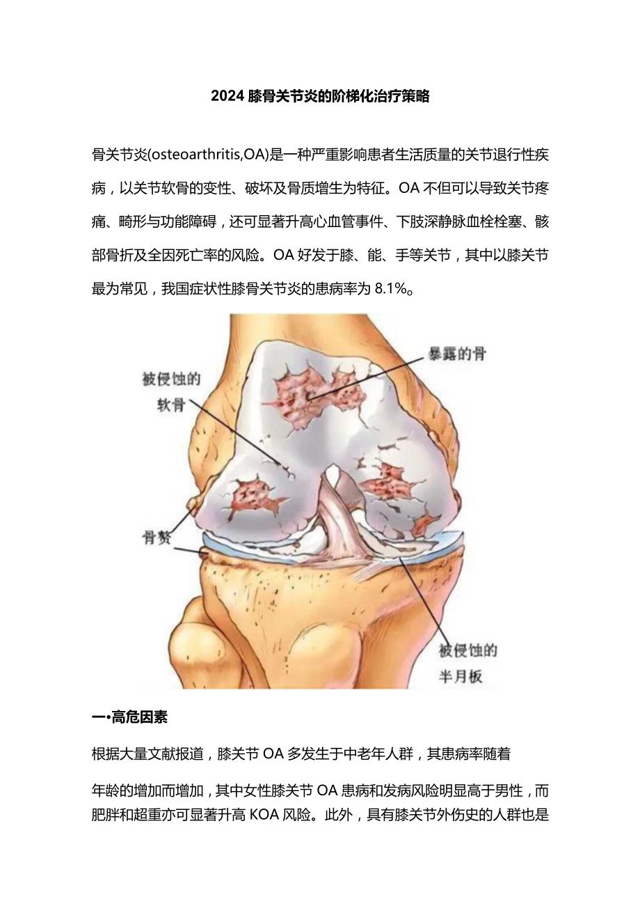 2024膝骨关节炎的阶梯化治疗策略.docx_第1页