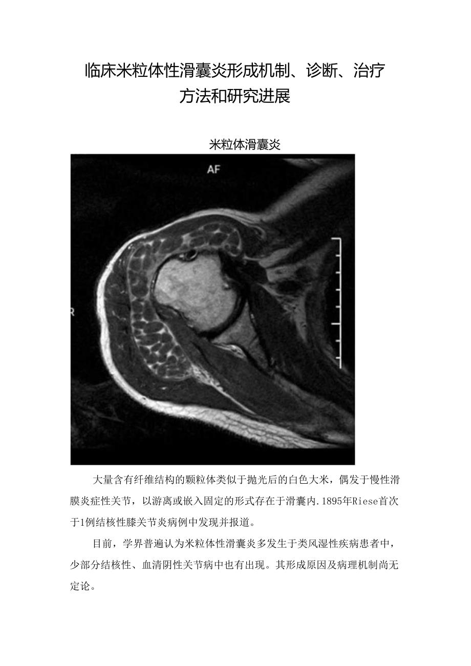 临床米粒体性滑囊炎形成机制、诊断、治疗方法和研究进展.docx_第1页