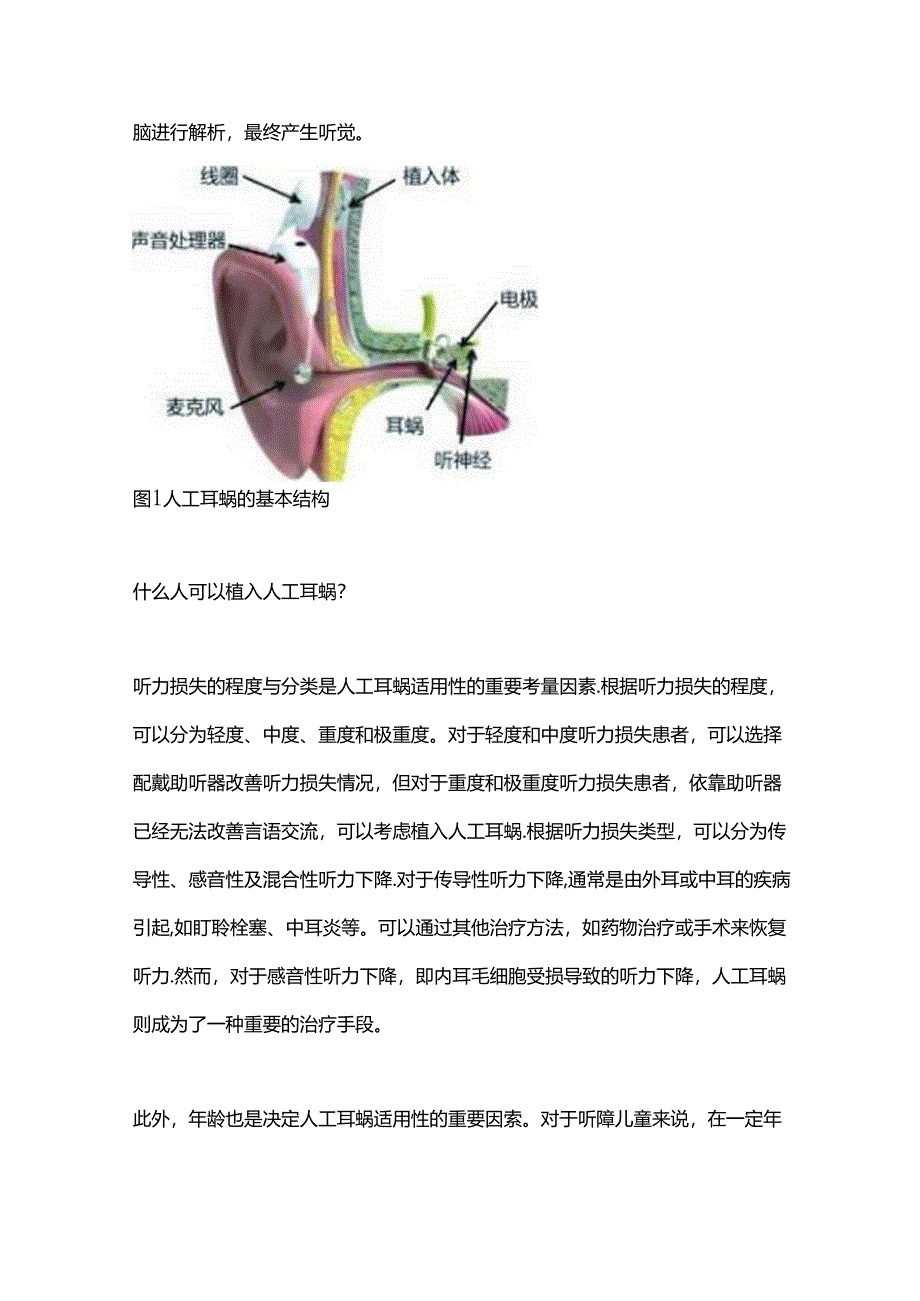 2024人工耳蜗基础知识要点（全文）.docx_第2页