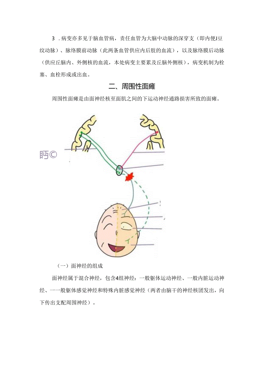 临床中枢性面瘫与周围性面瘫诊断及特征性症状.docx_第3页