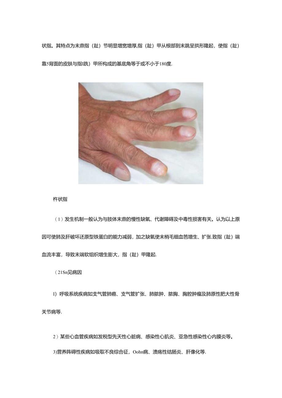 体格检查四肢与关节检查.docx_第2页