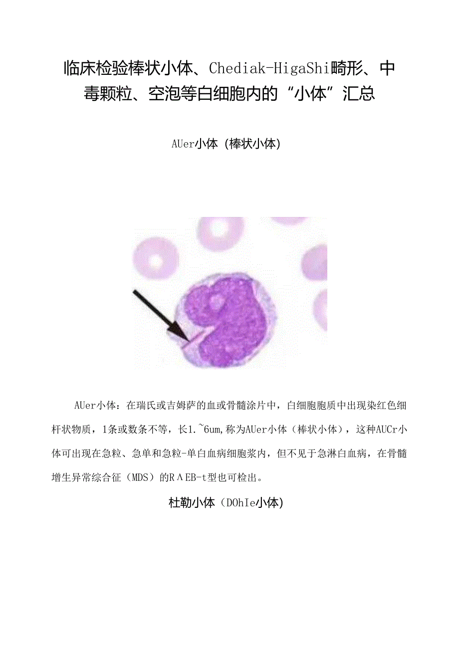 临床检验棒状小体、Chediak-Higashi畸形、中毒颗粒、空泡等白细胞内的“小体”汇总.docx_第1页