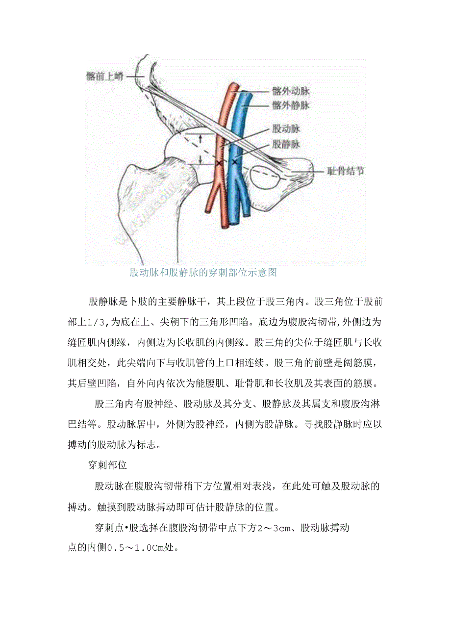 临床股静脉穿刺步骤、注意事项、潜在并发症原因及处理.docx_第2页