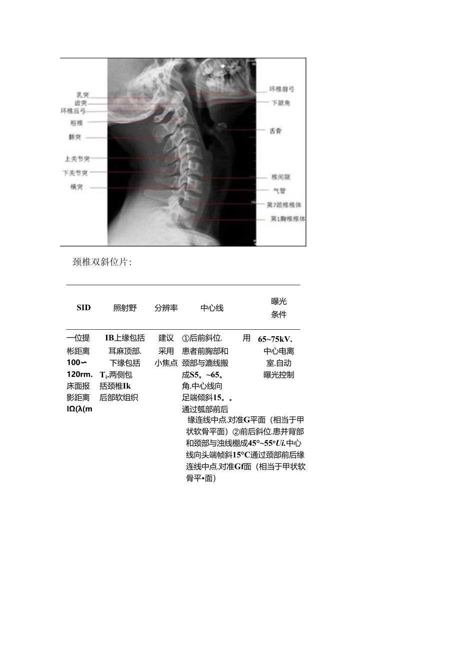 临床颈椎X线摄影距离摄影思考.docx_第3页