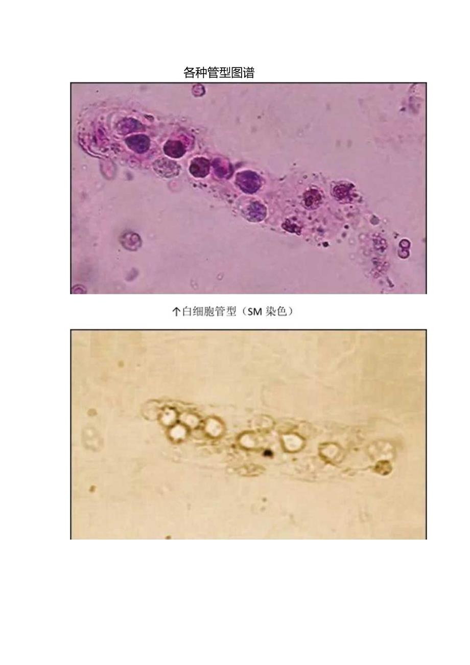 临床尿管型检查及图谱.docx_第2页