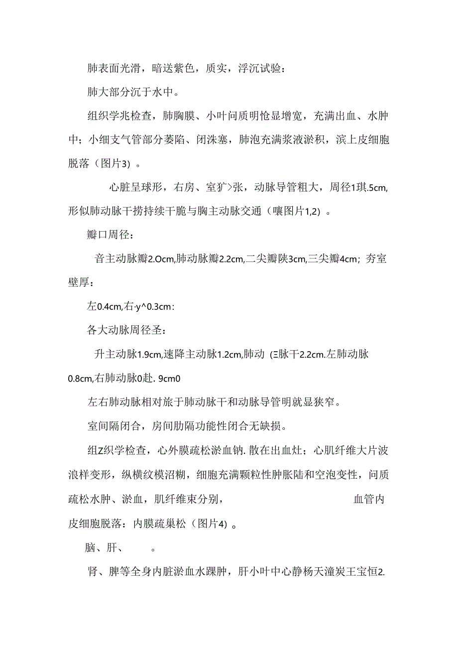 先天性肺动脉狭窄合并动脉导管扩张1例.docx_第2页