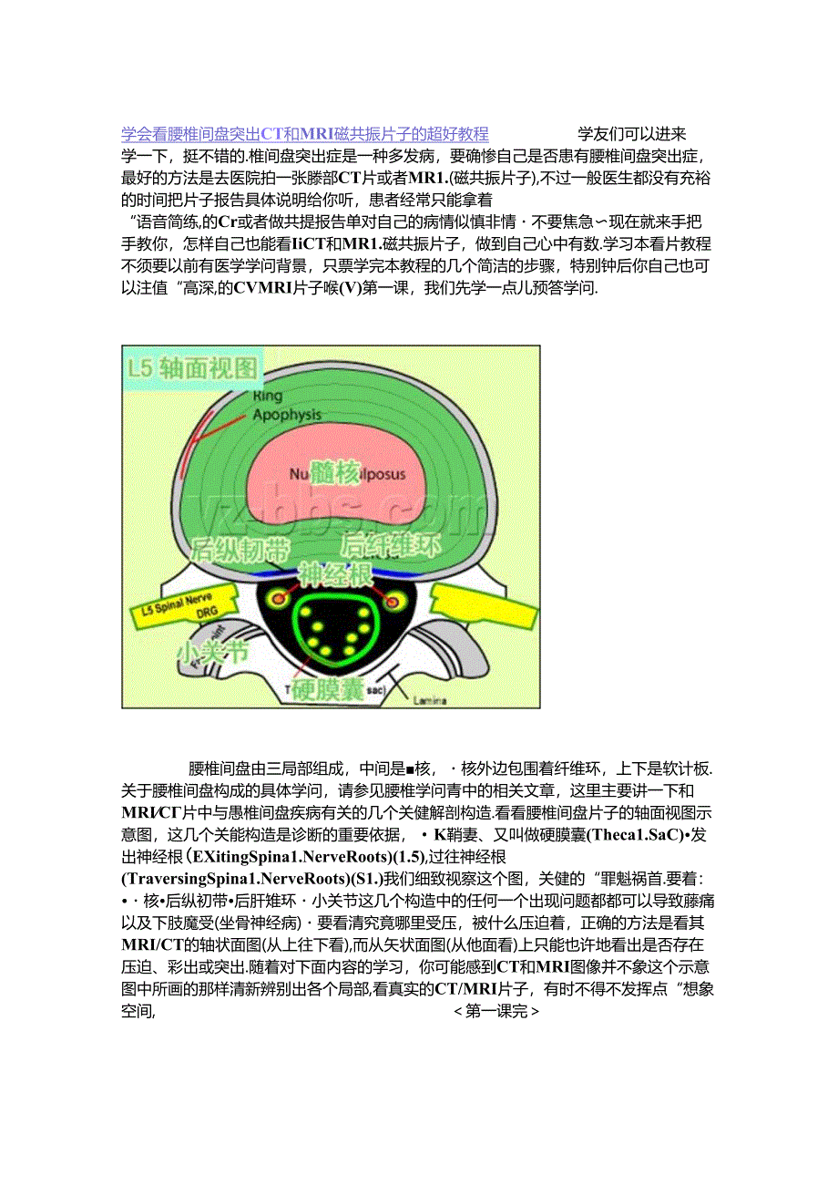 学会看腰椎间盘突出CT和MRI磁共振片子的超好教程.docx_第1页