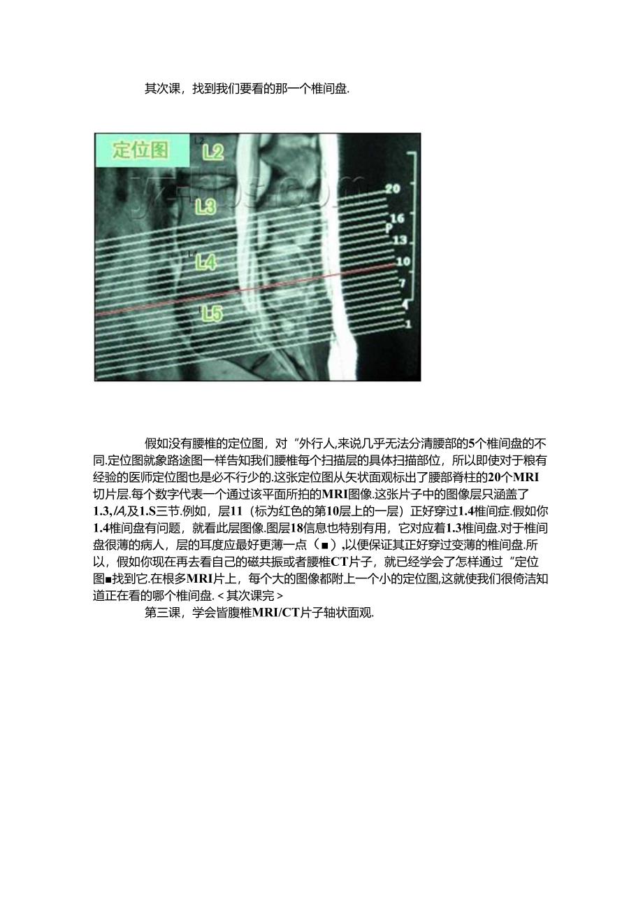 学会看腰椎间盘突出CT和MRI磁共振片子的超好教程.docx_第2页