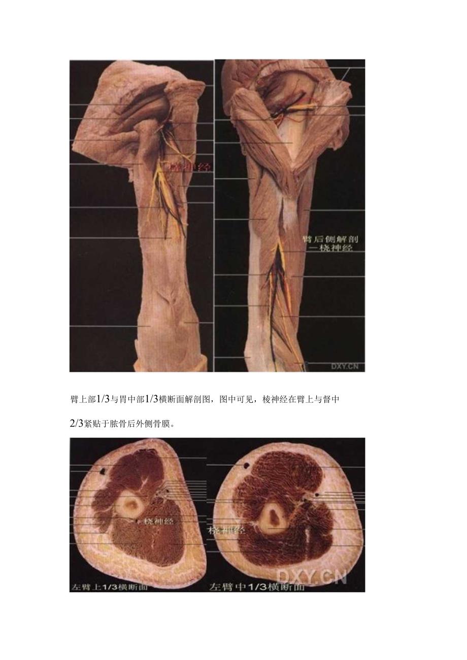 常见的桡神经卡压三个部位解剖及诊断.docx_第3页