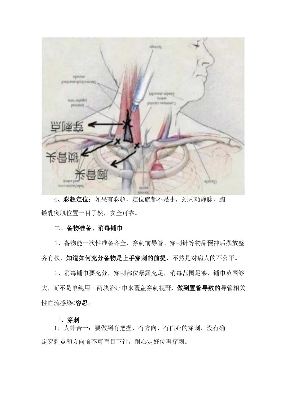 颈内静脉血透导管穿刺置管要点.docx_第2页