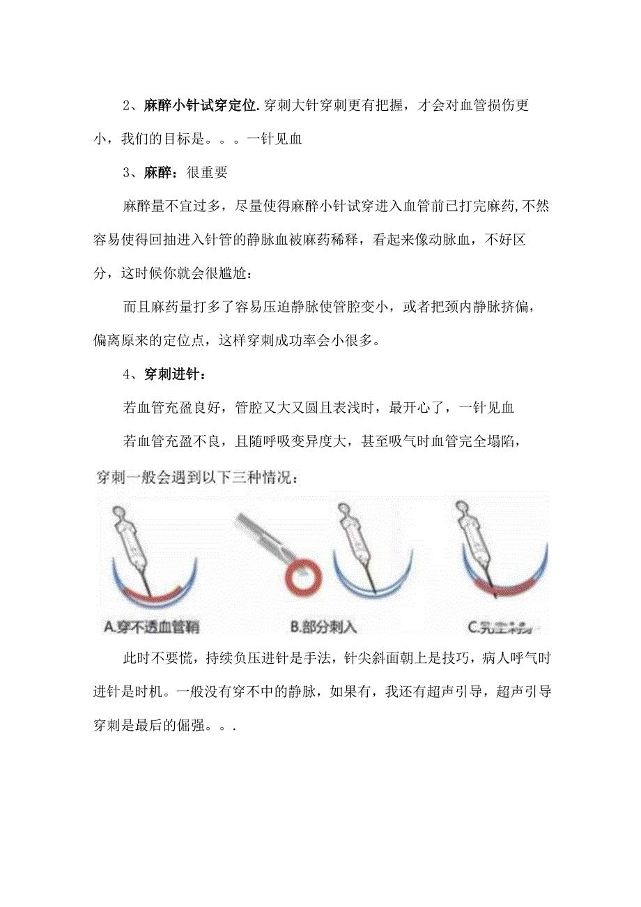 颈内静脉血透导管穿刺置管要点.docx_第3页