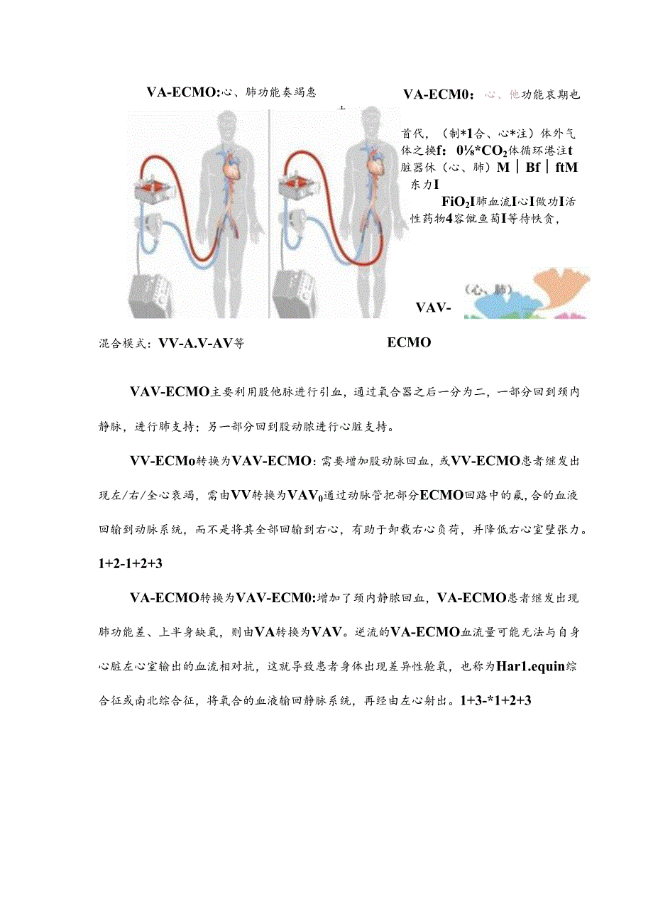 ECMO护理基础小知识.docx_第3页