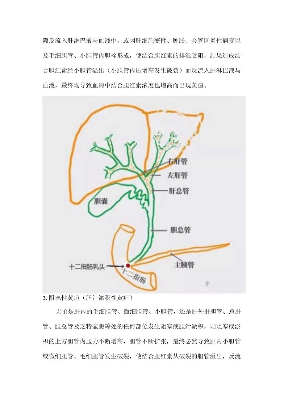 黄疸的分类及发生机制.docx_第2页